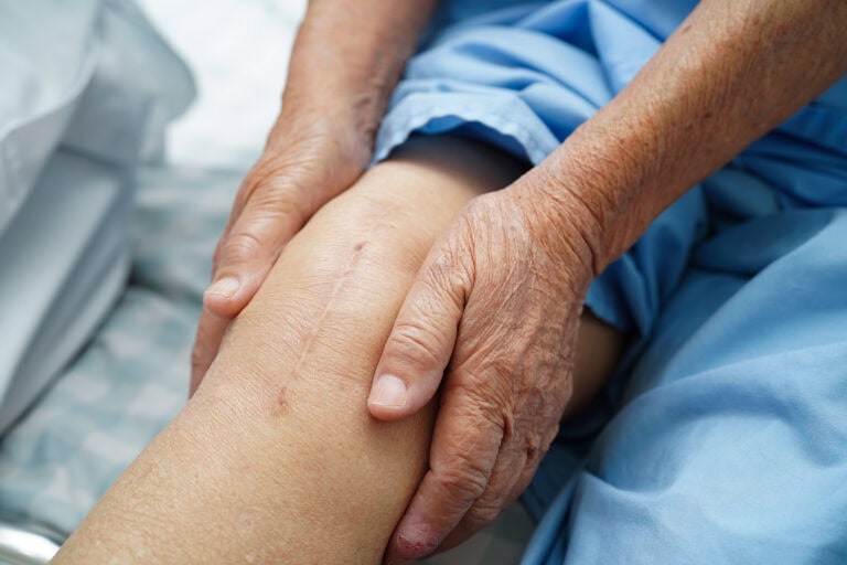 Patient experiencing chronic knee pain after surgery.